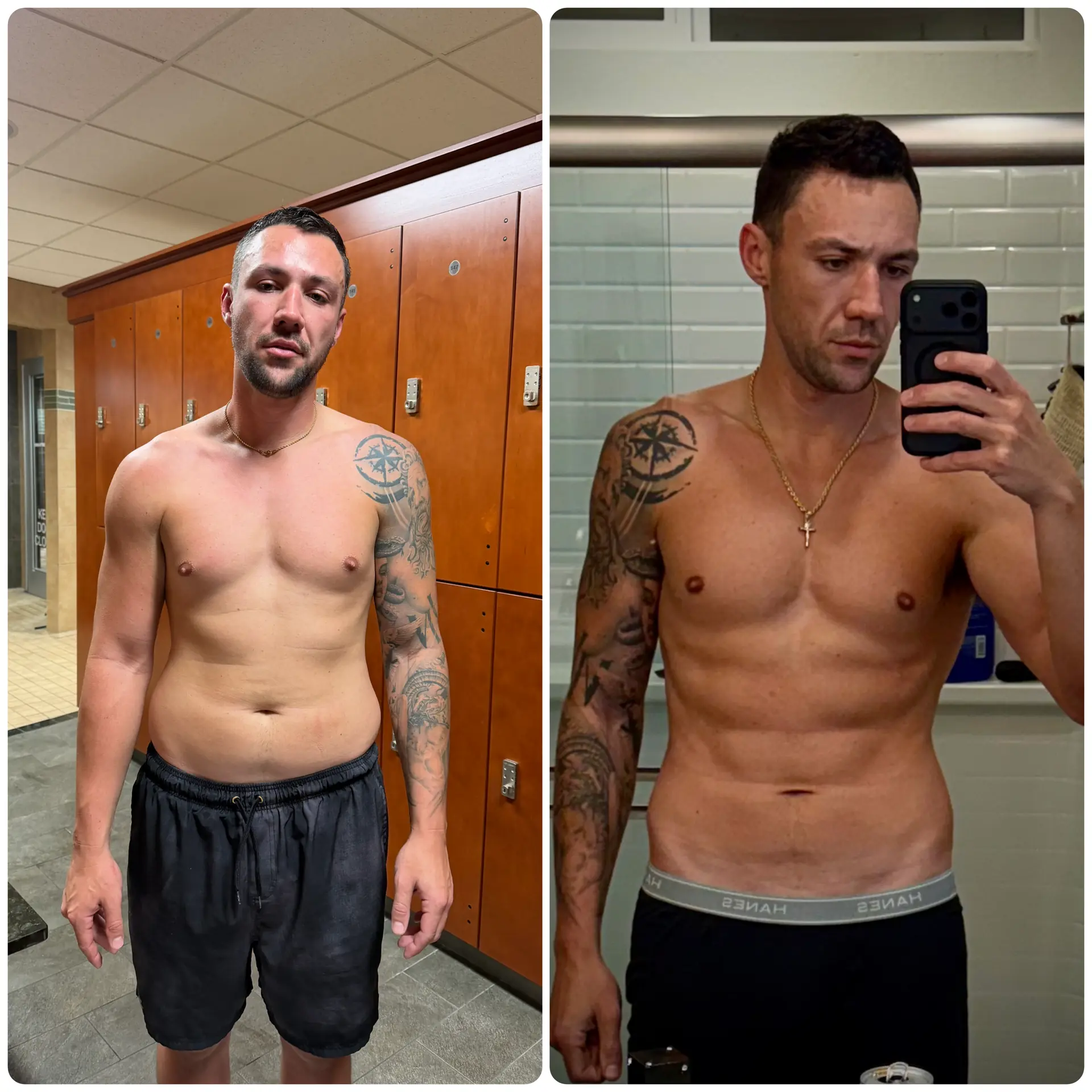 Second man's before-and-after body composition comparison for a tesamorelin results guide